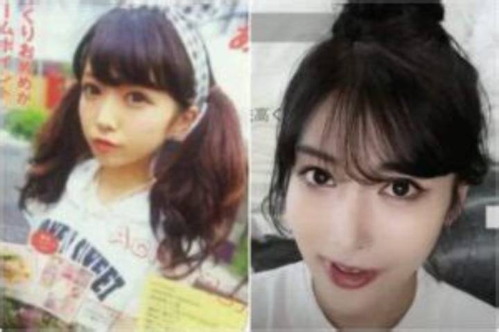 Rちゃん整形前の顔とは？真相と噂を徹底検証